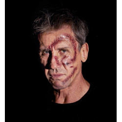 Tetovanie - jazvy po zraneniach